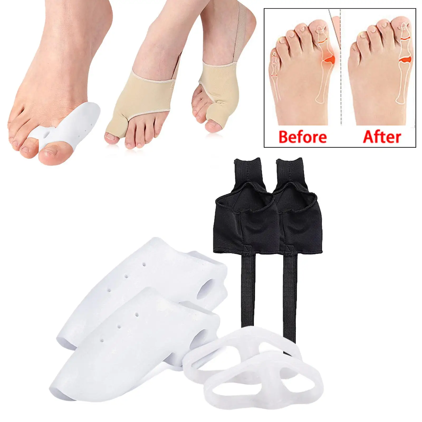 Bunion Corrector Kit Toe Splitter Toe Separator Orthopedic Bunion Relief Toe Straightener Toe Guard Bunion Pads Sleeves Brace