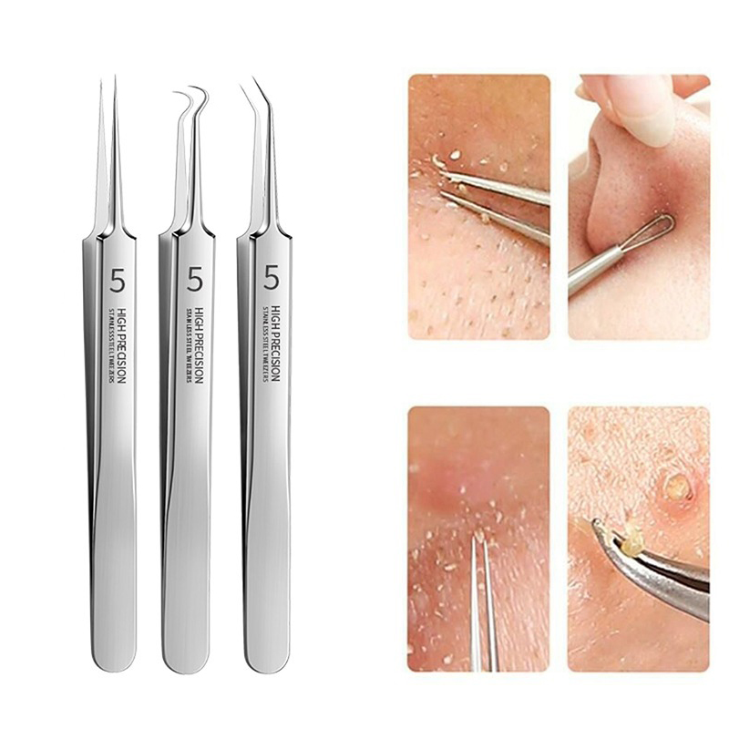 Best of Ultra-fine No.5 Cell Pimples Blackhead Clip Tweezers Beauty Salon Special Scraping Closing Artifact Acne Needle Tools Facial Reviews & Tips