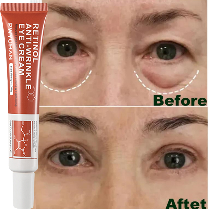 Best of Retinol Remove Eye Bag Eye Cream Fast Eliminating Puffy Dark Circle Delays Aging Anti-Wrinkles Firming Brighten Skin Man Woman Reviews & Tips