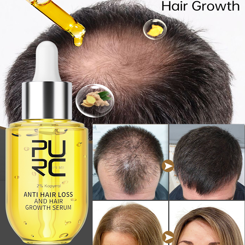 Best of PURC Fast Hair Growth Products For Men Women Ginger Hair Regrowth Thicken Serums Thinning Hair Loss Treatment Oil Hair Care Reviews & Tips