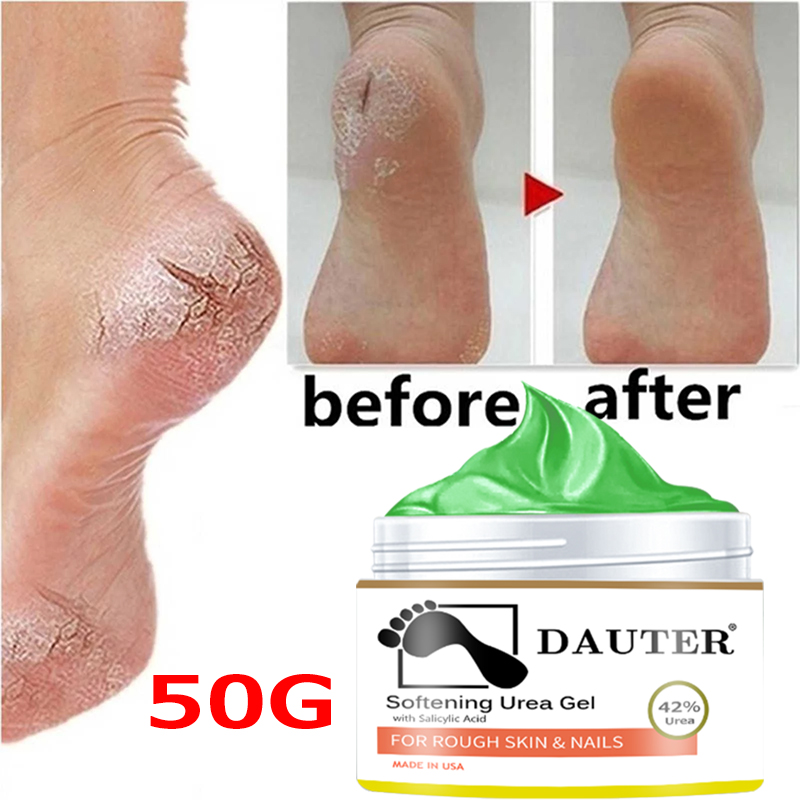 Best of Chinese Herbal Medicine Foot Cream Hand And Foot Mask Moisturizing Anti-drying Heel Chapped Repair Calluses Dead Skin Care Reviews & Tips