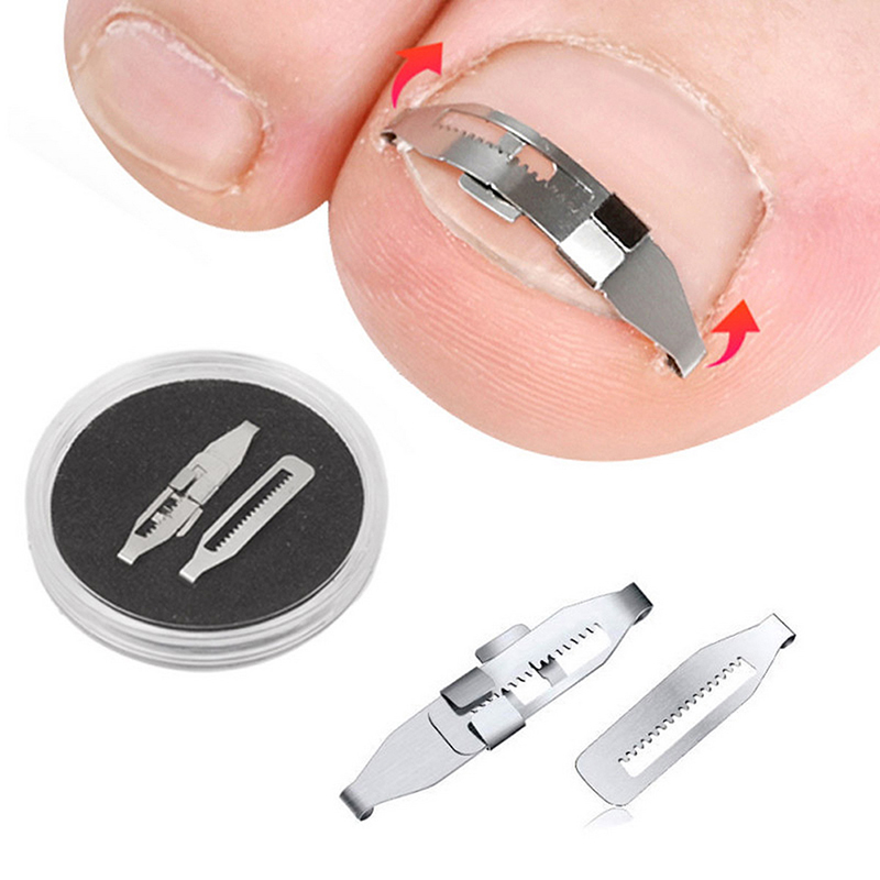 Best of 1pcs Ingrown Toenail Corrector Tools Pedicure Recover Embed Toe Nail Treatment Professional Foot Care Correction Tool Care Foot Reviews & Tips