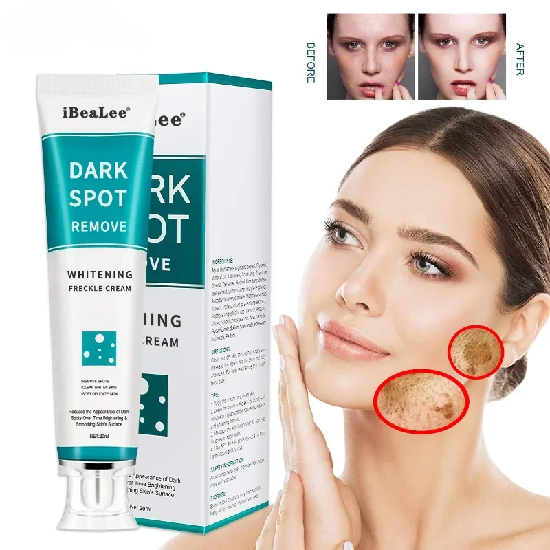 Best of Whitening Freckles Cream Remove Melasma Dark Spots Lighten Melanin Remover Moisturizing Brightening Face Skin Care 20ml Reviews & Tips