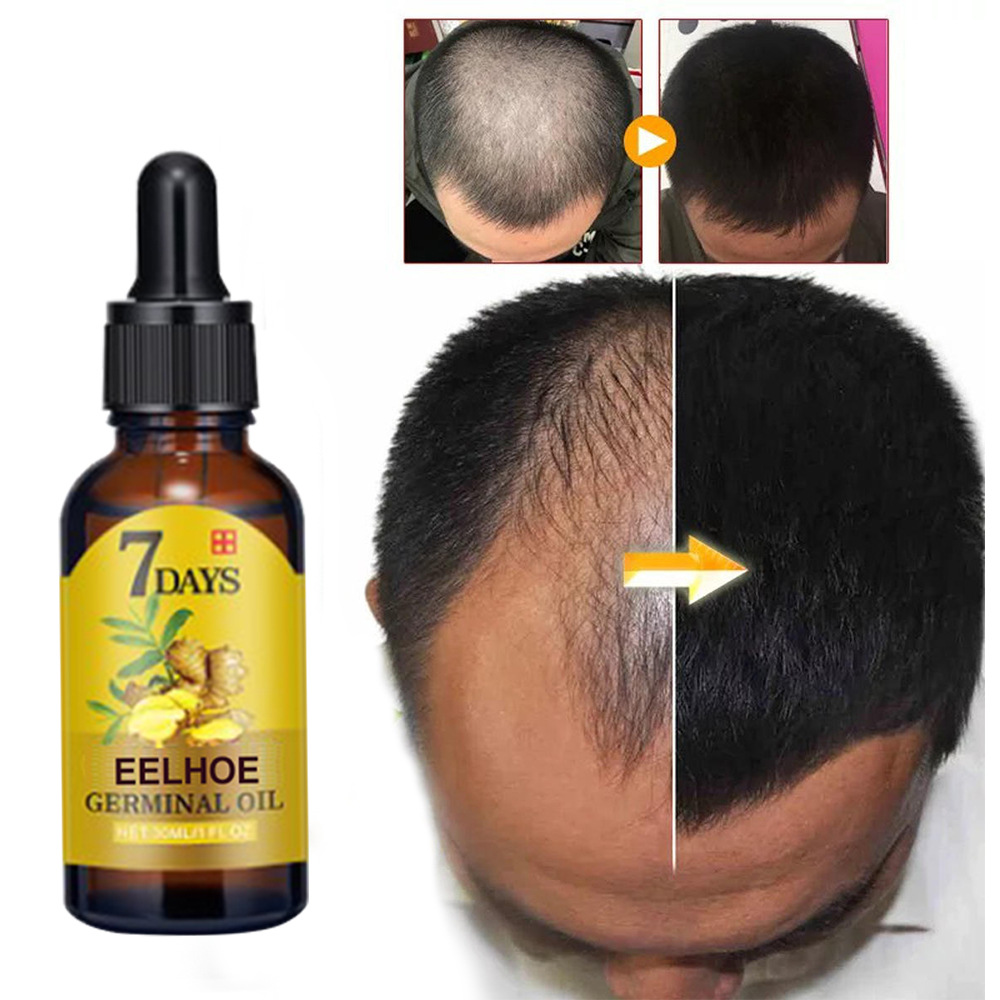 Best of EELHOE 7 Days Hair Growth Serum Oil 20ml Dense Regrowth Ginger Hair Care Repair Liquid Essential Anti Loss Hair Products Reviews & Tips