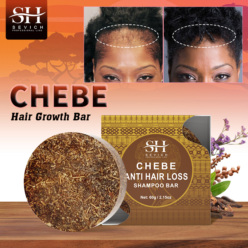 Best of 2023 Chebe Shampoo Bar For Hair Regrowth African Crazy Traction Alopecia Anti Hair Break Hair Strengthener Hair Loss Treatment Reviews & Tips