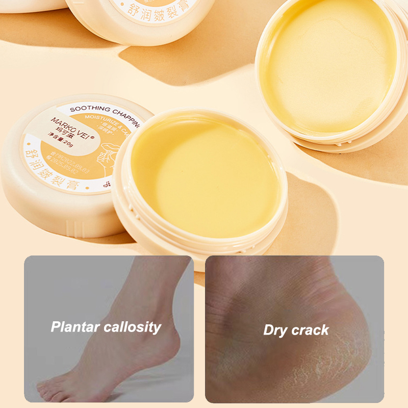 Best of 20g Herbal Anti Crack Foot Cream Oil Anti-Drying Crack Feet Cream Heel Cracked Repair Cream Removal Bad Skin Hand Feet Care Mask Reviews & Tips