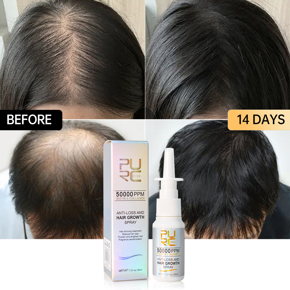 Best of PURC Biotin Fast Hair Growth Products For Men Women Anti Hair Loss Serum Spray Scalp Treatment Thicken Regrowth Oil Hair Care Reviews & Tips