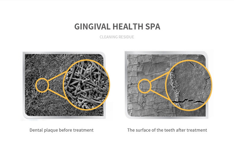 Title 7, Irrigatore orale Detergente per denti Getto d