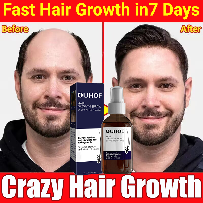 Best of Hair Growth Spray Fast Growing Prevent Hair Loss Essential Oil Treatment Consolidating Nourish Roots Hair Health Repair Products Reviews & Tips