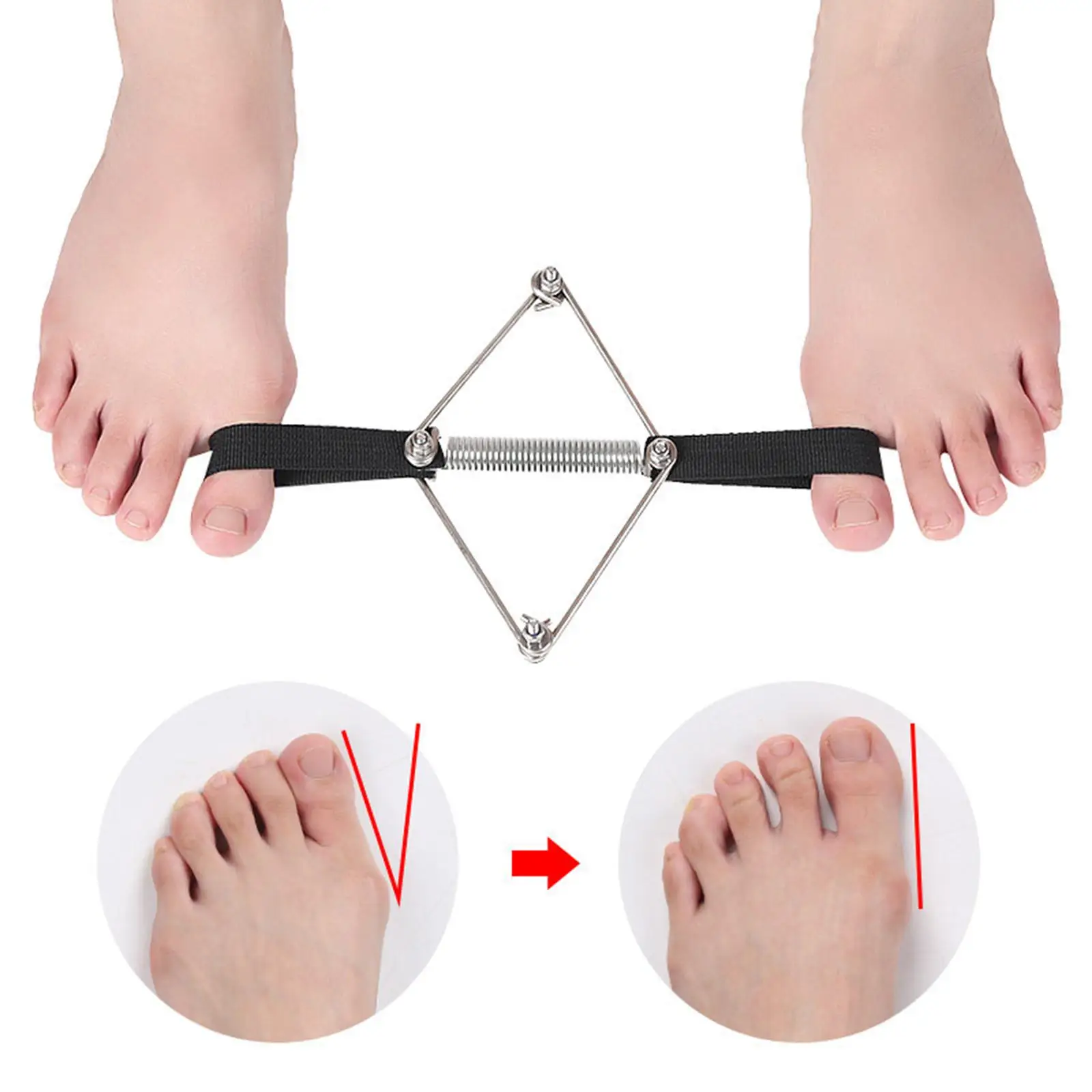 Bunion Corrector Elastic Exerciser for Hammer Toes Toe Alignment 