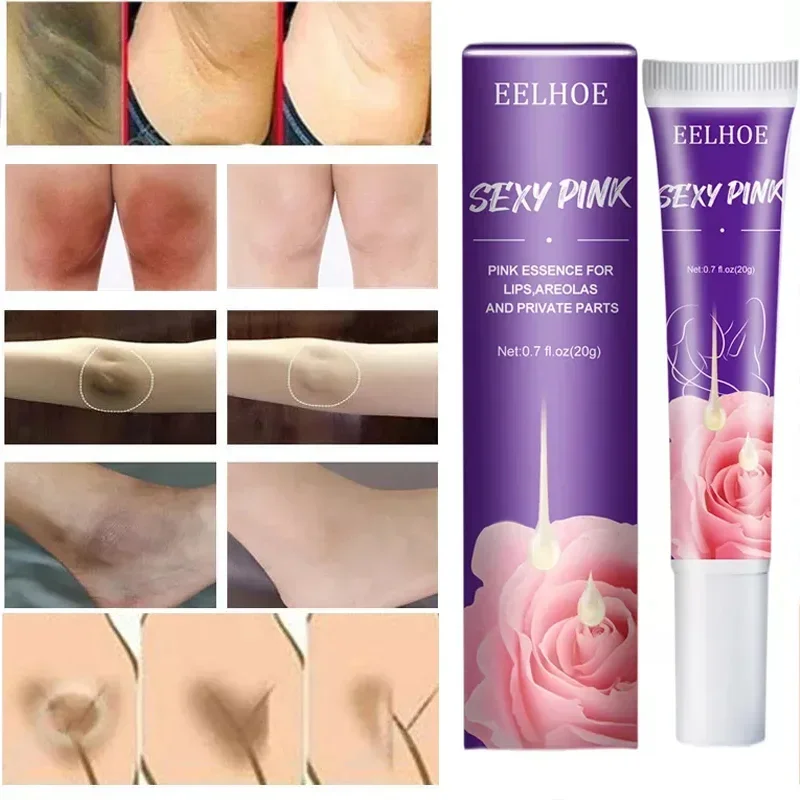 Best of Body Whitening Cream Intimate Area Pink Essence Underarm Knee Butt Dullness Brighten Improve Lip Moisturizer Facial Beauty Care Reviews & Tips