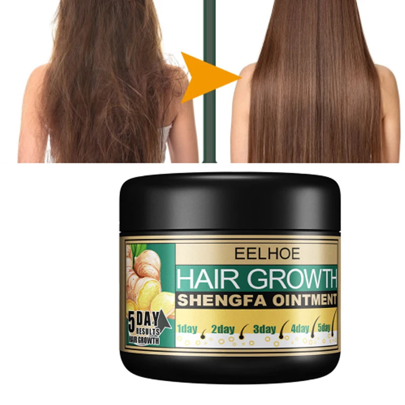 Best of Ginger Cream To Promote Hair Growth Place Hair Loss Relieving Scalp Massage Stimulate Hair Follicle Smoothing Cream Reviews & Tips