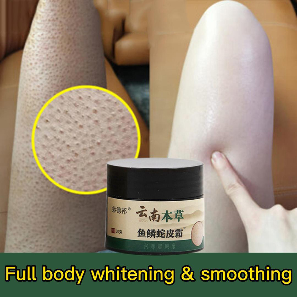 Best of New Chicken Skin Repair Cream Curing Keratosis Follicle Pilaris Remove Thick Pores Body Dark Spot Moisturize Smooth Skin Care Reviews & Tips