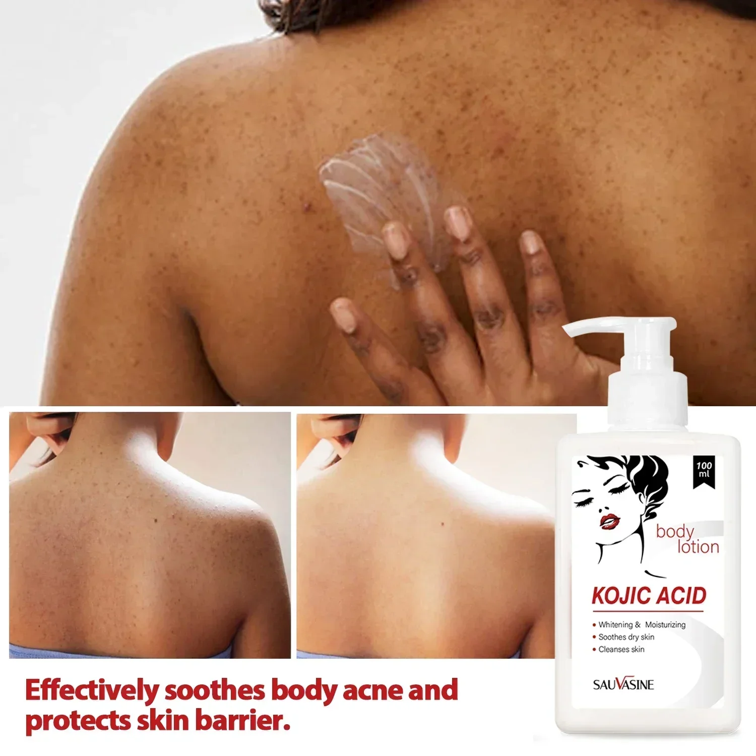 Best of Kojic Acid Whitening Lotion Skin Whitening Cream Acne Dark Spots Remover Moisturizing Lightening Skin Care Product Beauty Health Reviews & Tips