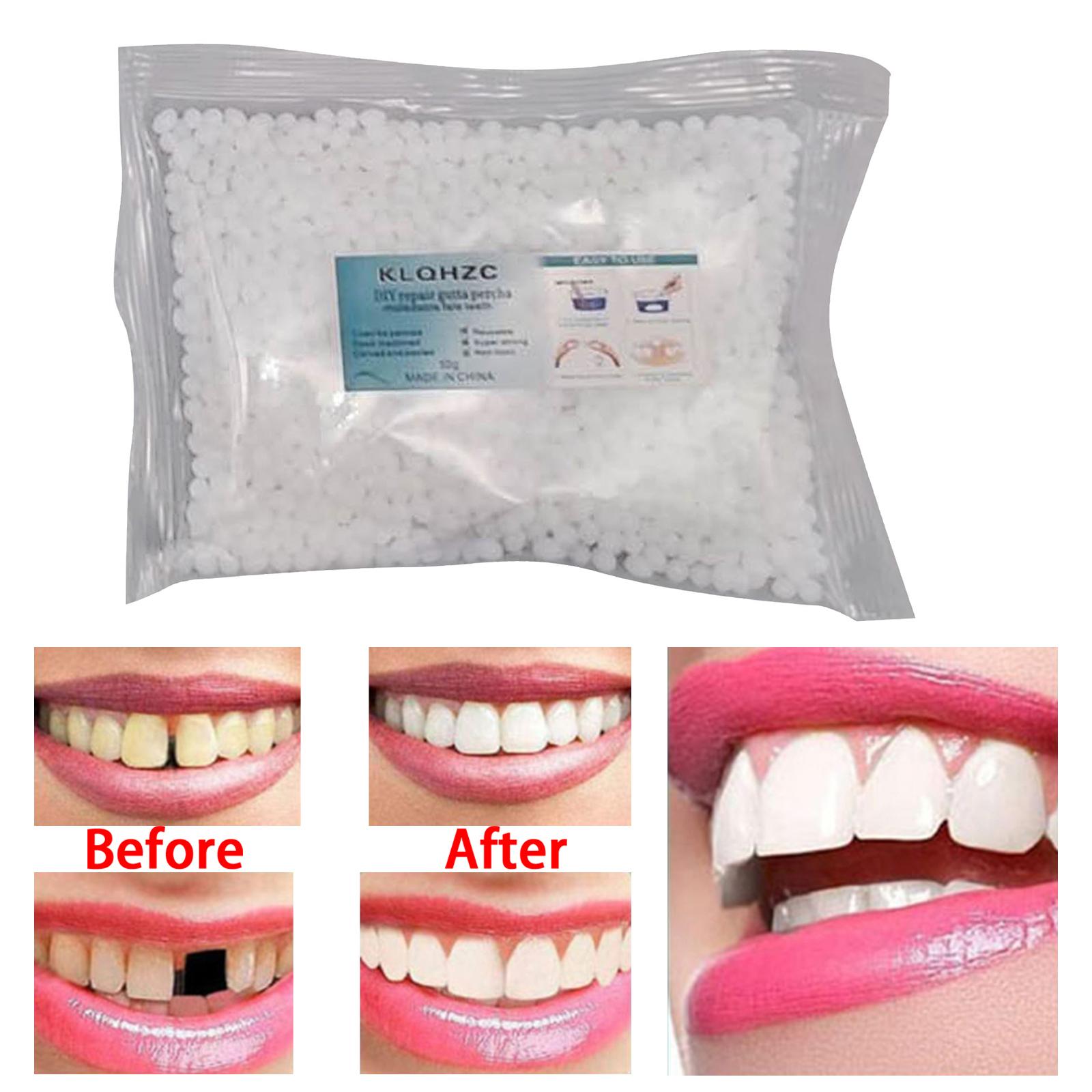Teeth Repair Kit Teeth Veneers Fix The Missing Tooth Teaching Confident Smile Tooth Adhesive Oral Care Easy to Use Thermal Beads