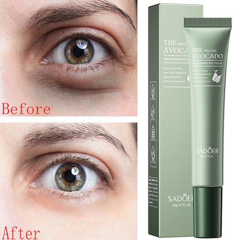 Best of Remove Dark Circles Eye Cream Anti-Wrinkle Fade Fine Lines Moisturizing Relieving Dry Skin Remove Eye Bags Puffiness Eye Care Reviews & Tips