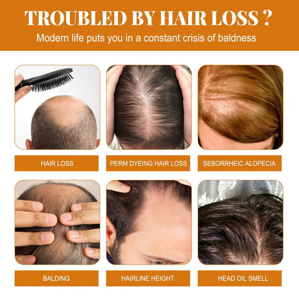 Description Picture 6 of itemHorse Oil Shampoo for Hair Loss Vibrant Hair Loss Shampoo Safe Healthy Odor-free Nourishing Solution with Horse Oil for Healthy