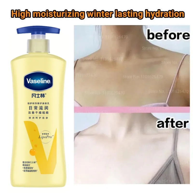 Best of Vaseline Body Lotion Niacinamide Whitening Moisturizing Body Lotion Autumn And Winter Body Lotion Moisturizing 400ml Reviews & Tips