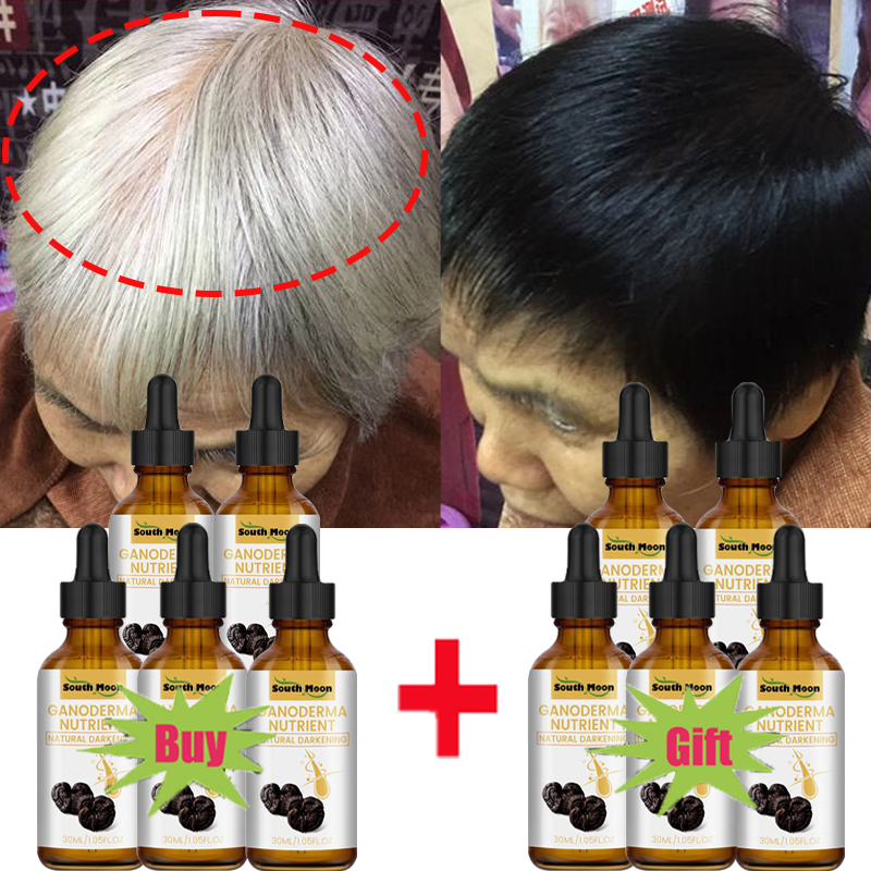 Best of 10PCS Gray White Hair Treatment Serum Liquid White To Black Natural Color Repair Nourish Essence Anti Loss Hair Care Products Reviews & Tips