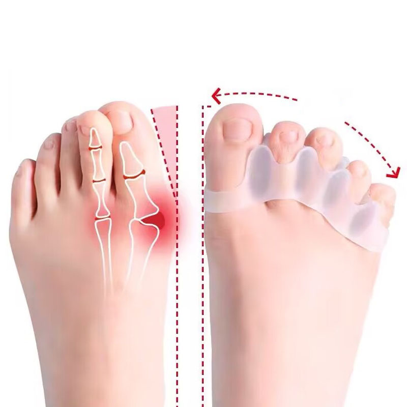 Best of 2Pc Silicone Toe Separator Fingers Feet Toe Spreader Hallux Valgus Bunion Corrector Toe Straightener Corrector Finger Separators Reviews & Tips