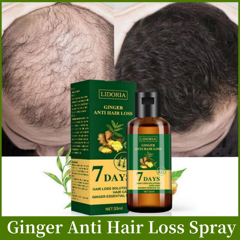 Best of Ginger Hair Growth Product Anti-loss Hair Regrowth Serum Oil Fast Grow Prevent Baldness Treatment Alopecia Men Women Hair Care Reviews & Tips