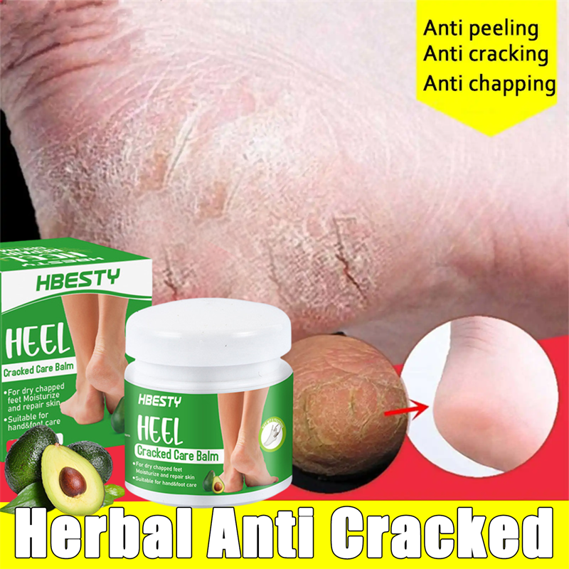 Best of Herbal Anti Cracked Heel Treatment Cream Anti-Drying Removal Callus Dead Skin Balm Hand Foot Mositurizing Repair Skin Care Mask Reviews & Tips