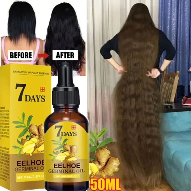 Best of 5pcs 7 Days Fast Ginger Hair Growth Serum Anti Hair Loss Fast Growing Hair Care Essential Oil Repair Damaged For Women Men 200ML Reviews & Tips - Image 2