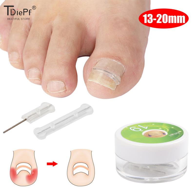 Best of 10pc / box Ingrown Toenail Correction Tool Ingrown Toe Nail Treatment Elastic Patch Sticker Straightening Clip Brace Pedicure Tool Reviews & Tips