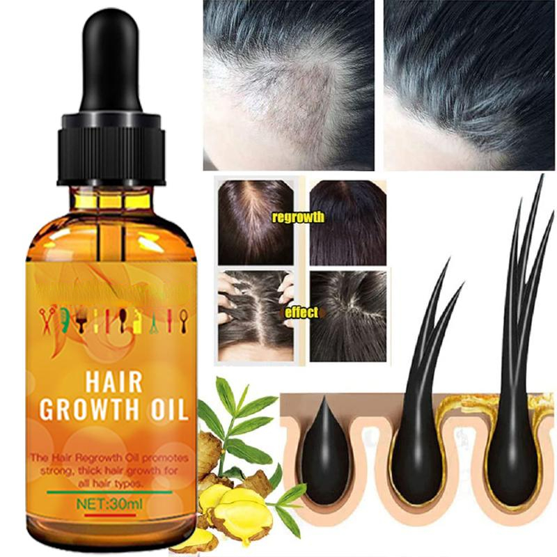 Best of Ginger Hair Growth Serum Essential Oil Anti Hair Loss Fast Grow Hair Growth Oil Essential Oil Treatments Health Care Beauty 30ml Reviews & Tips