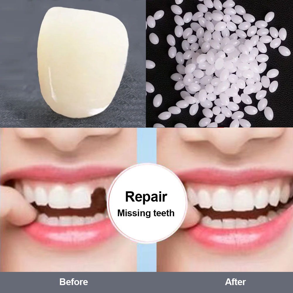 Best of Resin Tooth Permanent High Hardness Repair Glue Shapeable Teeth Gaps Filling Teeth Repair Falseteeth Glue Safety Dental Supplies Reviews & Tips