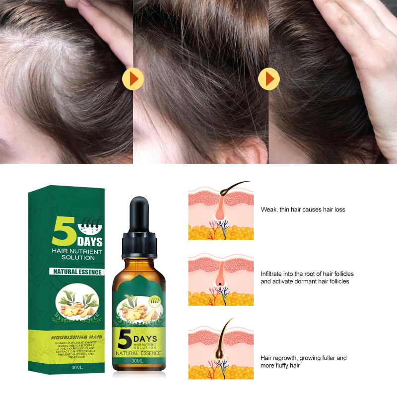 Best of Ginger Hair Growth Essence Oil Nutrient Fast Growing Hair Prevent Hair Loss Oil Scalp Treatment Oil For Men Women Hair Care Reviews & Tips - Image 2