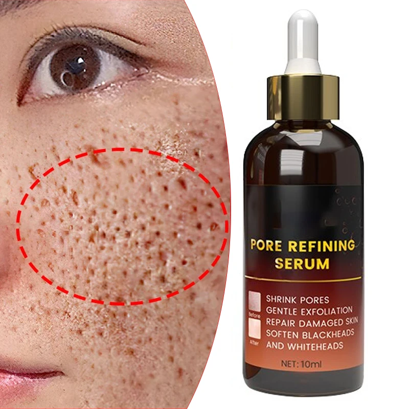 Best of Effective Pores Remover Pore Shrinking Serum Shrink Tightening Minimizing Reviews & Tips