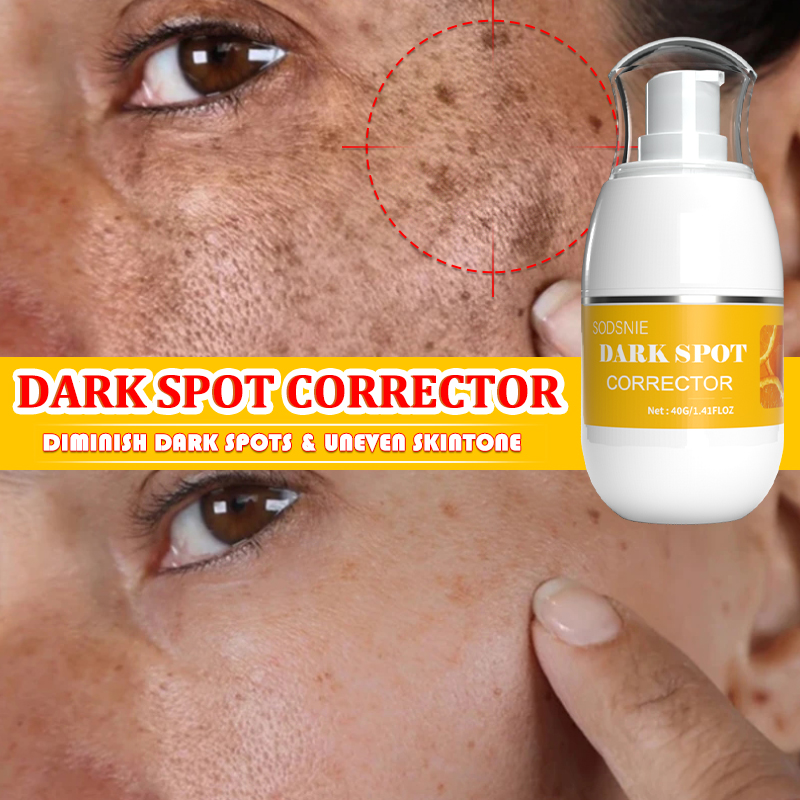 Best of Dark Spot Corrector Intense Freckle Cream Whitening Fade Removal Melasma Sun Spot Moisturizing Brightening Skincare Beauty 40g Reviews & Tips