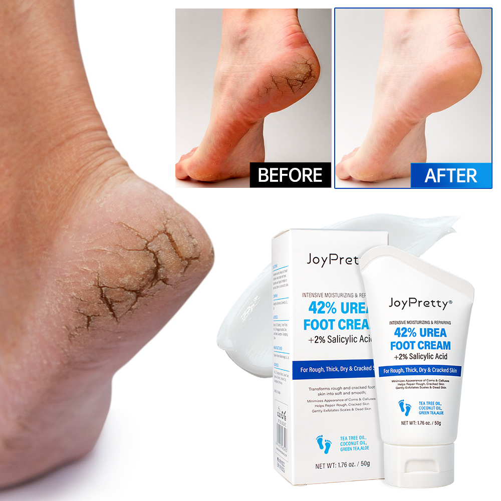 Best of Exfoliator Foot Cream Anti Crack Heel Foot Dead Skin Remover Urea Exfoliation Repair Treatment Hand Feet Creams Skin Care Mask Reviews & Tips