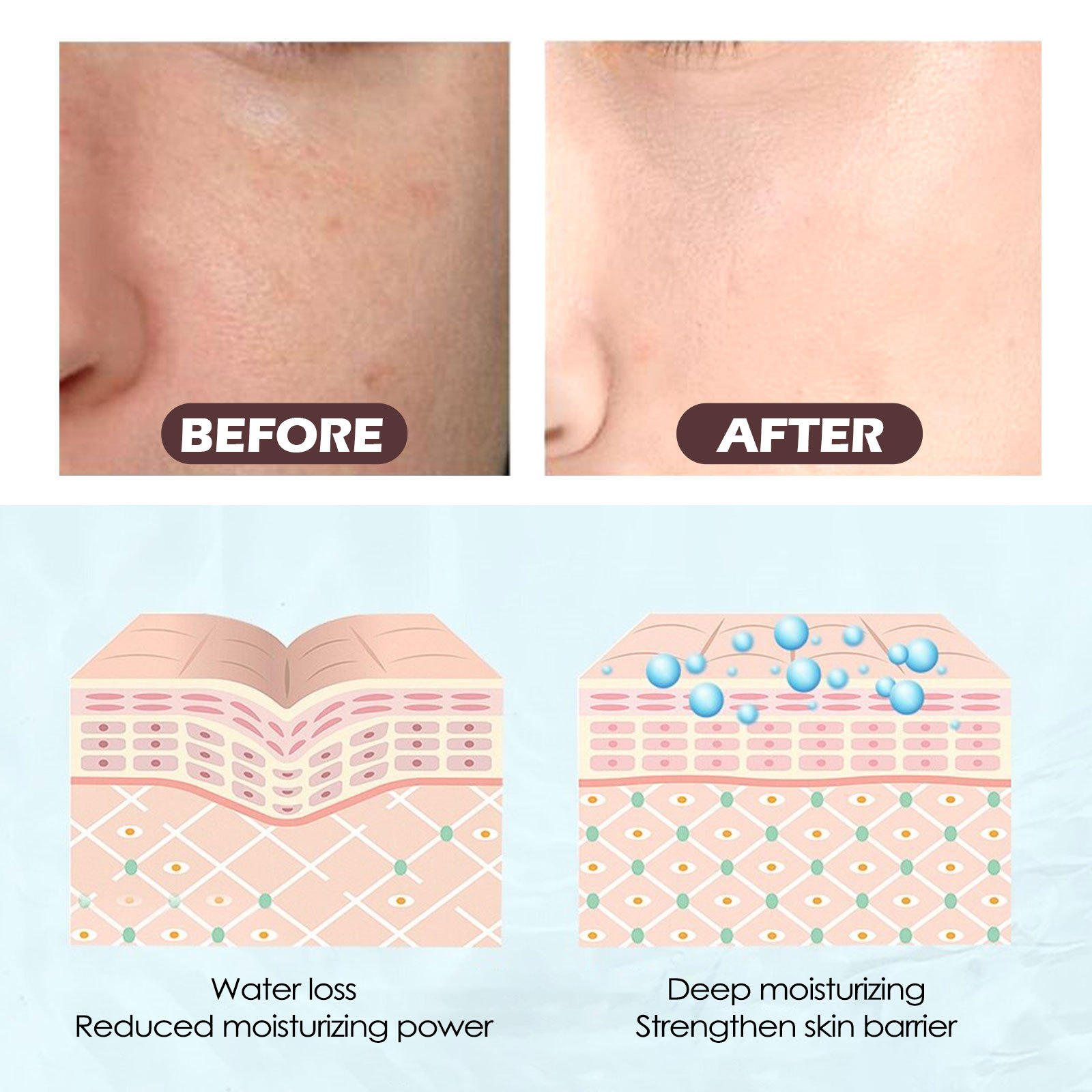 Rice Face Toner Anti Acne Dark Spot Remover Smooth Pore Oil Control Repair Rough Glow Rejuvenating Nourish Pore Shrinking Serum_voghion.com