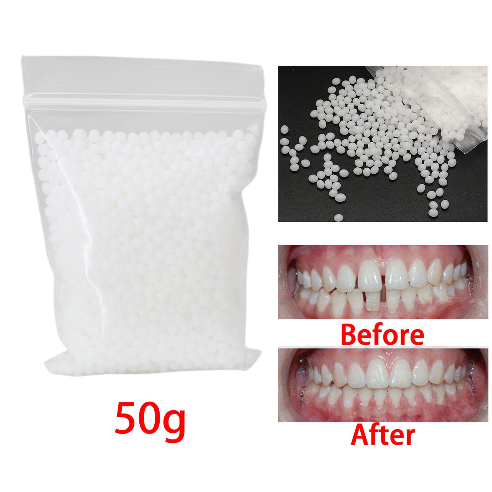 50G Temporary Tooth Repair Kit Adhesive Beads Moldable Fake Teeth Veneer