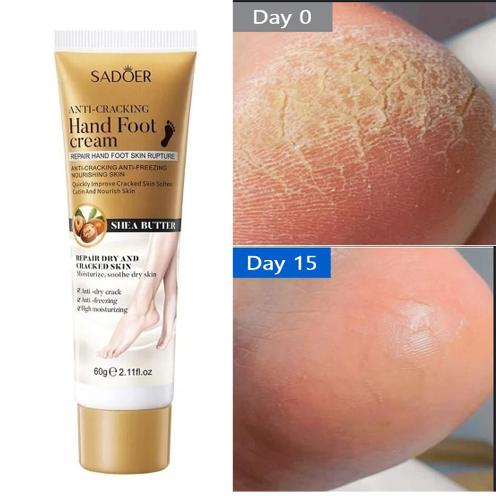 Best of Anti Crack Hand Foot Cream Anti-Drying Heel Cracked Repair Feet Mask Removal Dead Skin Moisturizing Whitening Feet Care Products Reviews & Tips