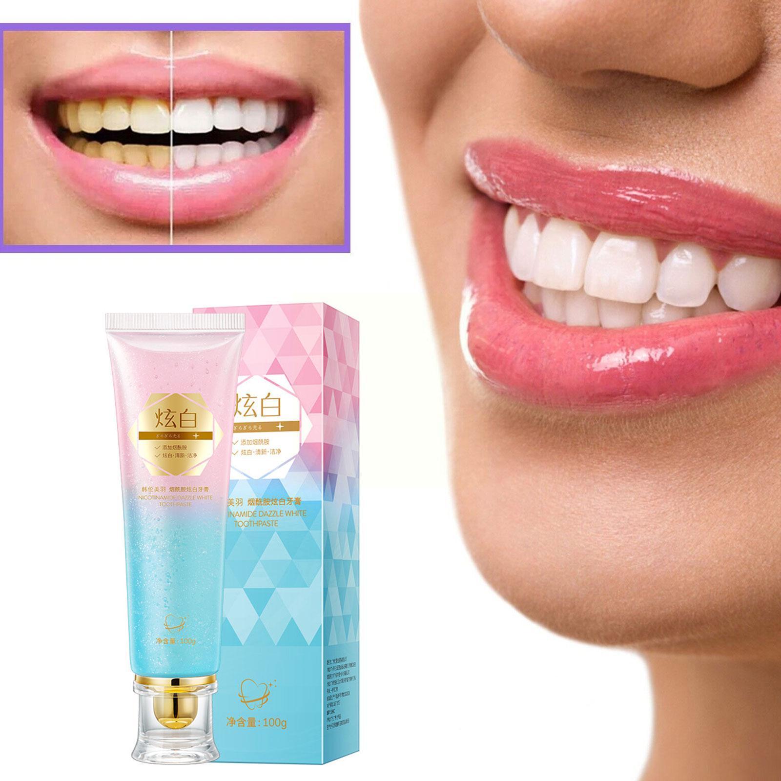 Best of Dazzling White Toothpaste Fresh Breath Niacinamide Toothpaste To Breath Remove To Care Teeth Tooth Bad Whitening Stains Rem X3A6 Reviews & Tips