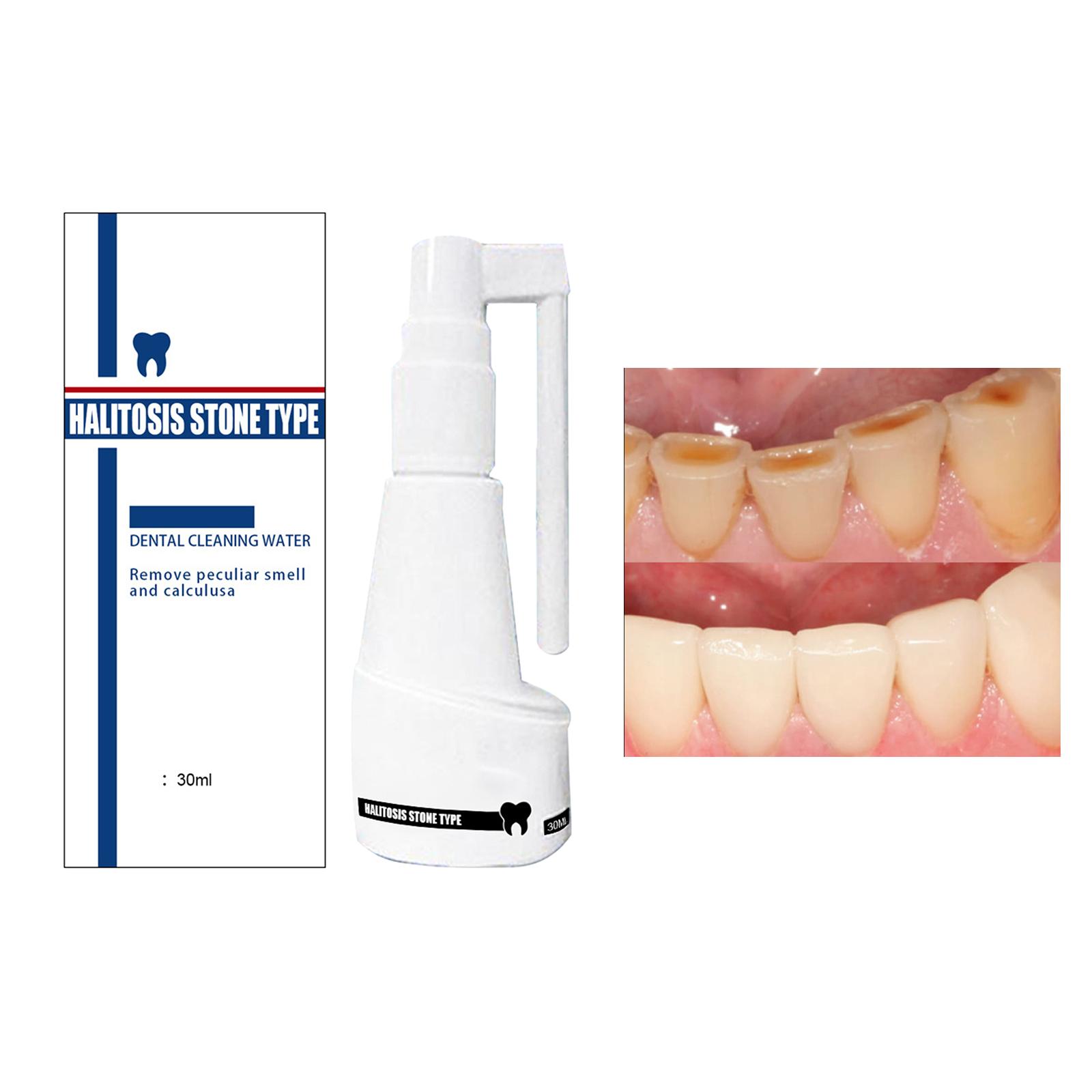 Mouth Clean Spray Antibacteria Stains Remover Tonsil Stones Fresh Breath Oral Care Mouth Freshener Bad Breath for Women Home Use