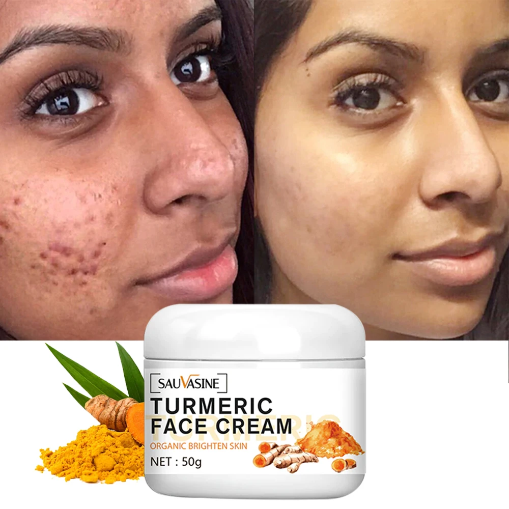 Best of Turmeric Skin Whitening Cream For Dark Skin Acne Treatment Lighten Dark Spots Moisturizing Brightening Cream For Face Skin Care Reviews & Tips