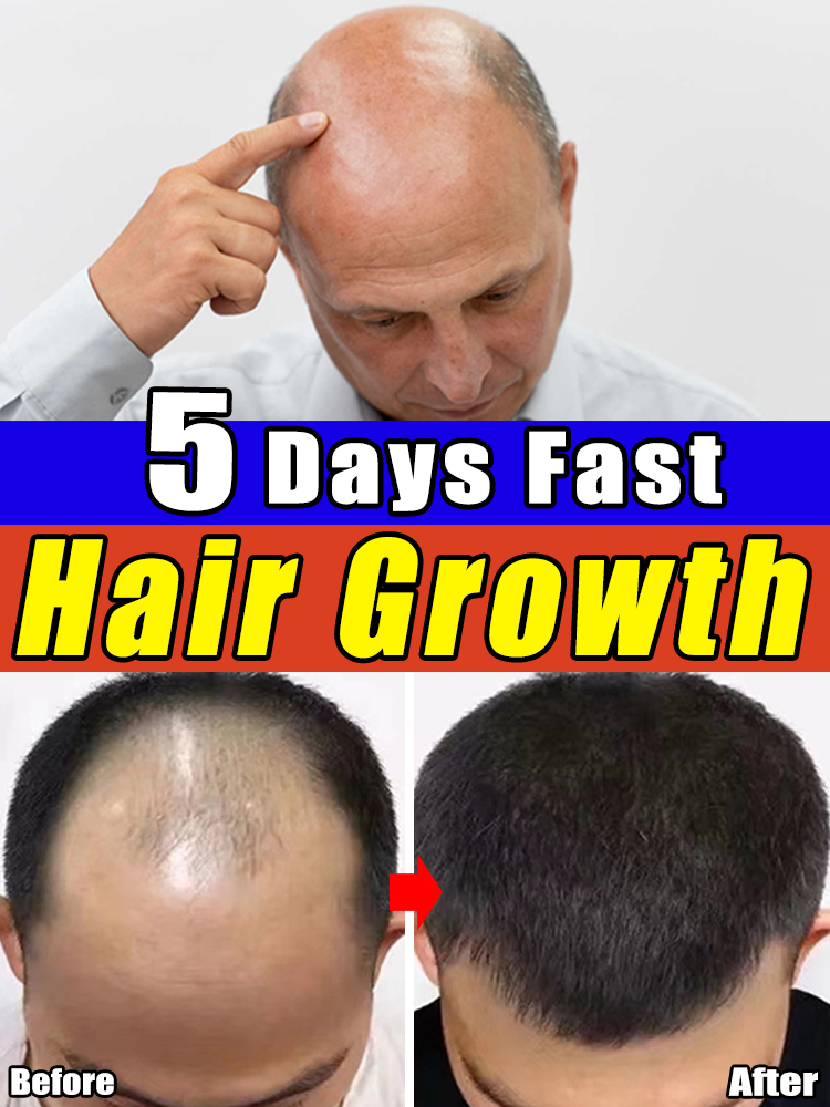 Best of Hair Growth Oil Fast Hair Regrowth Anti Hair Loss Products Reviews & Tips