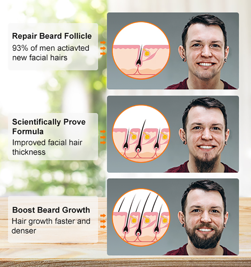 Best of Beard Growth Oil For Men Capillary Essential Oils Anti Hair Loss Beard Hair Follicle Repair Fast Hair Regrow Rosemary Beard Oil Reviews & Tips - Image 5