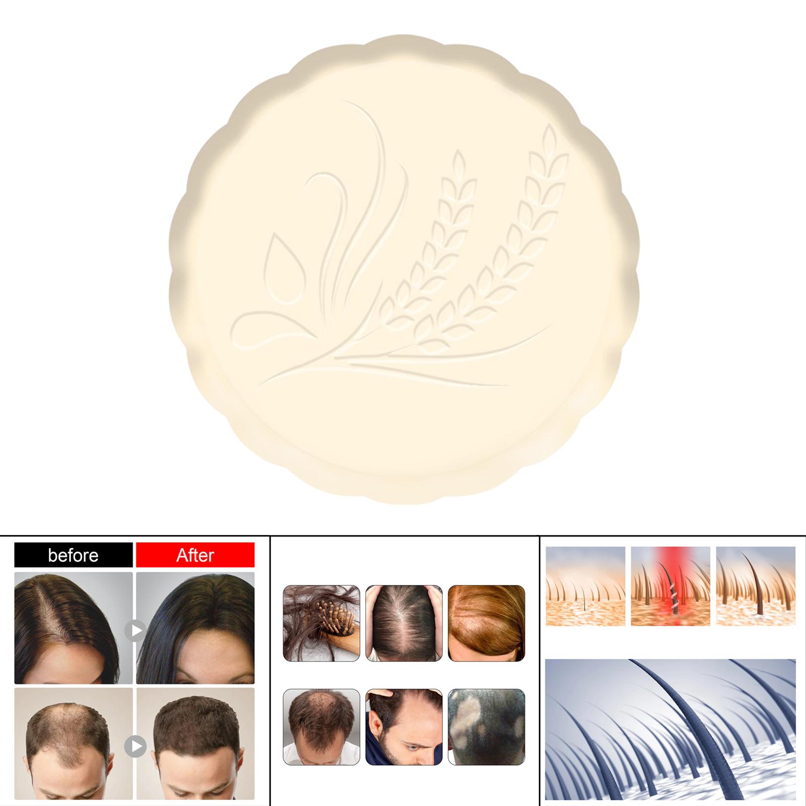 Rice Shampoo Bar Moisturizing Eco Friendly Solid Shampoo Soap for Hair Growth Promotes Healthy Hair Growth Dry Damaged Hair Girl