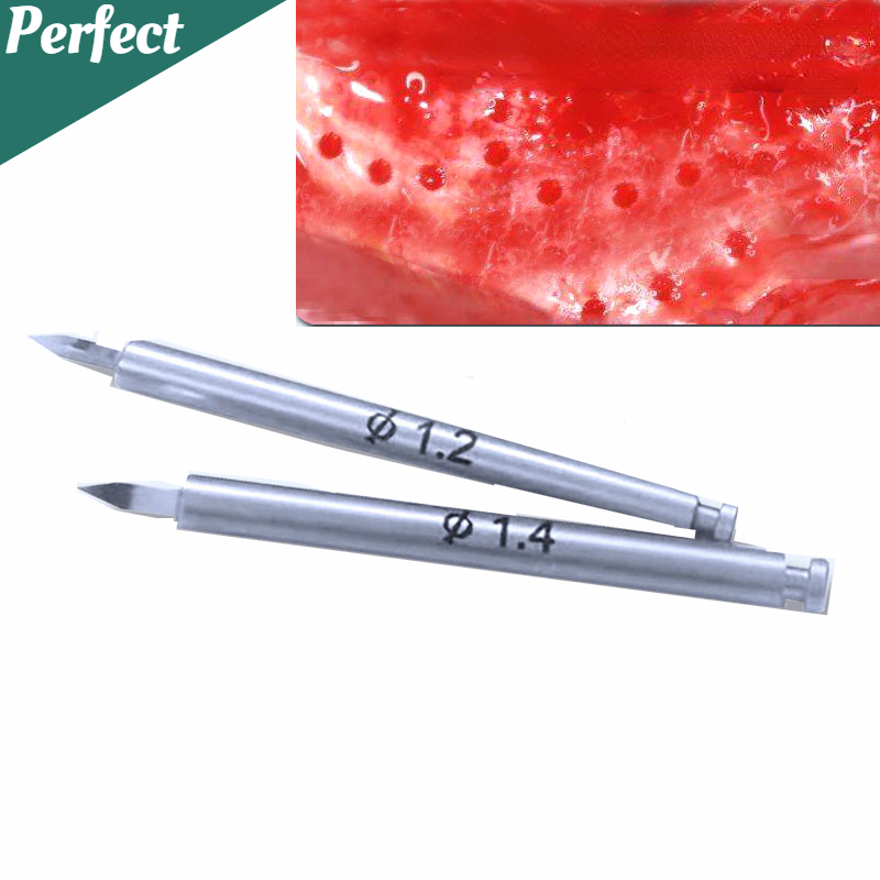 Best of Dental Nutrient Drill Implant Bone Increment Implant Nutrient Hole Drill Promote New Bone Formation Bone Drill Dental GBR Drill Reviews & Tips