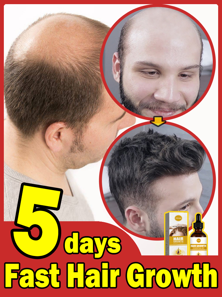 Best of Hair Growth Oil Fast Effective Baldness Repair Hereditary Postpartum Seborrheic Hair Loss Reviews & Tips