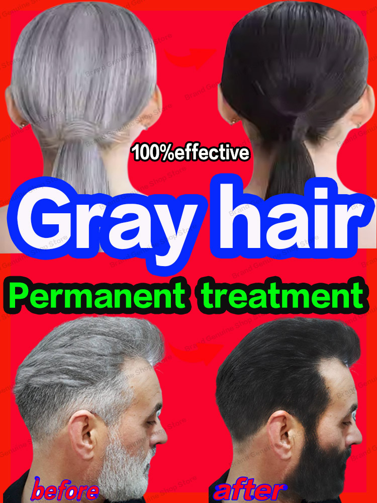 Best of White Hair Treatment Serum Fast White To Black Repair Anti Gray Hair Reviews & Tips