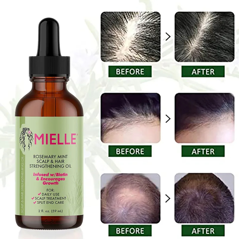 Best of Mielle Rosemary Original Hair Growth Essential Oil Mint Scalp Hair Strengthening Oil For All Hair Types Nourishing Treatment Reviews & Tips - Image 2