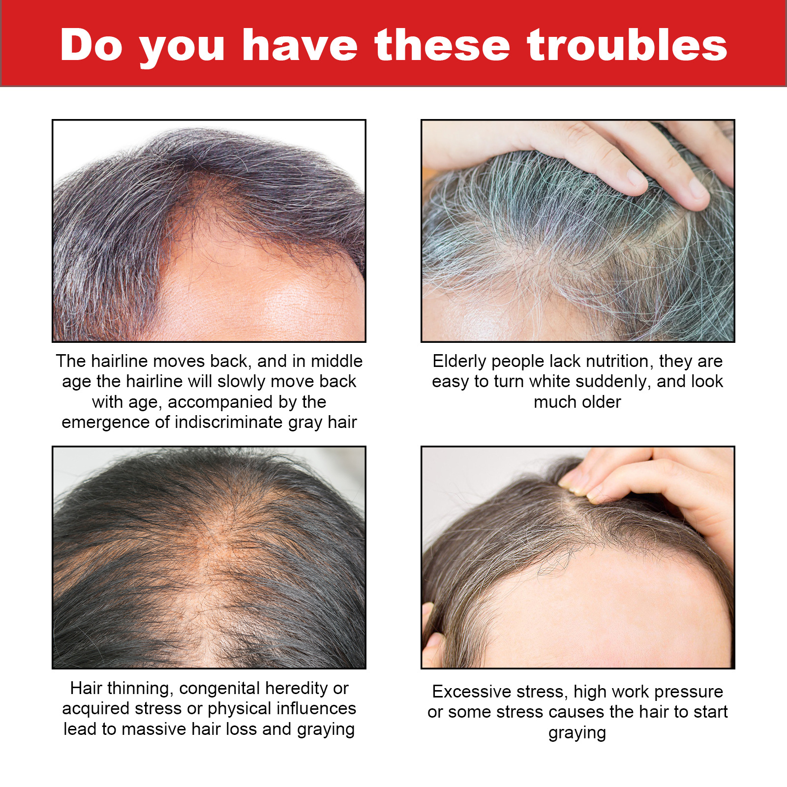 Description Picture 6 of itemHair Darkening Shampoo Repair Gray White Hair Color Prevent Thinning Nourishing Roots Scalp Treatment Smooth Black Hair Shampoo