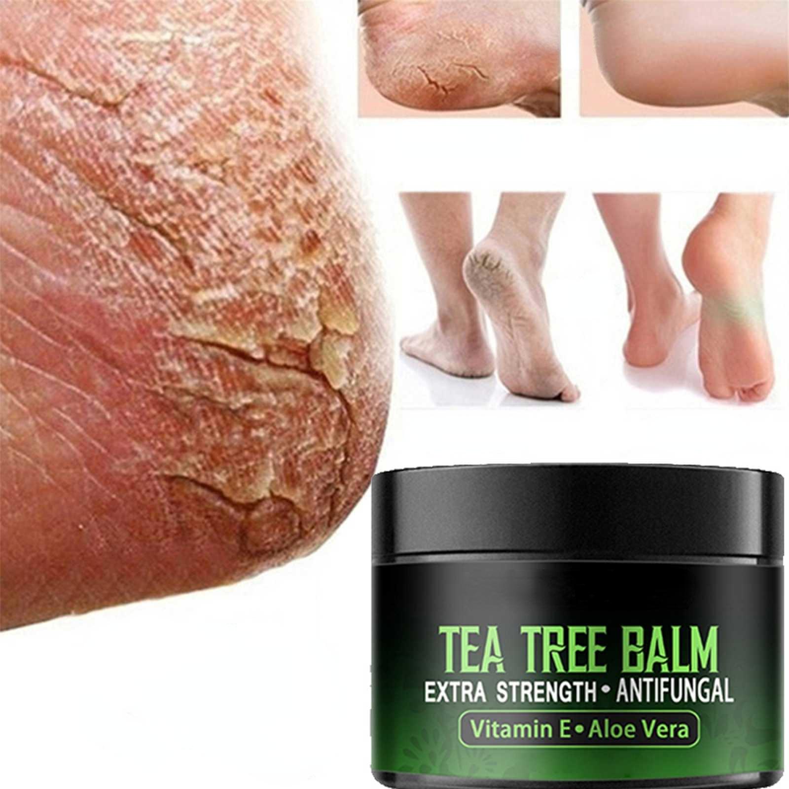 Best of Anti-Drying Crack Foot Cream Heel Cracked Repair Cream Removal Dead Skin Hand Feet Care Hand And Foot Skin Care Reviews & Tips