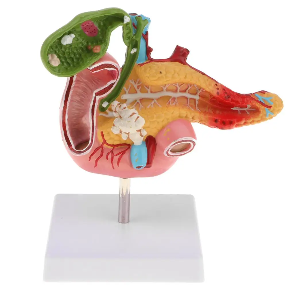 1:1 Human Pancreas Duodenum Gallbladder  Model,  Teaching Tools Aid, Lab Supplies